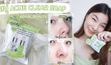 ลดสิวแพ้แมสก์ กันหน่อยแม่! กับสบู่ แอคเน่ เคลียร์ โซป จาก Royal Beauty